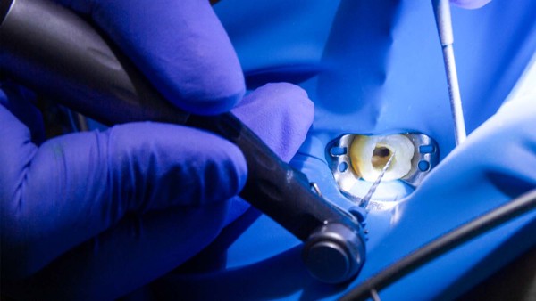 gerl-endodontie-ein-upgrade-im-bereich-der-wurzelbehandlung